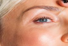 How Face Fillers Can Improve Skin Texture And Appearance